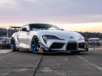 Supra Kit